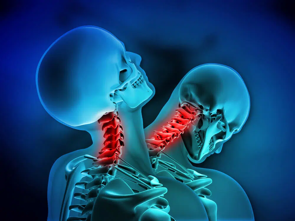 3D illustration of spine problems cause of personal injuries 