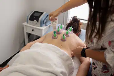 cupping therapy for back pain treatment in burbank