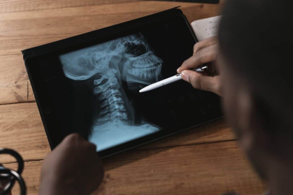 Chiropractor in Burbank reviewing a neck X-ray to diagnose cervicogenic headache causes.