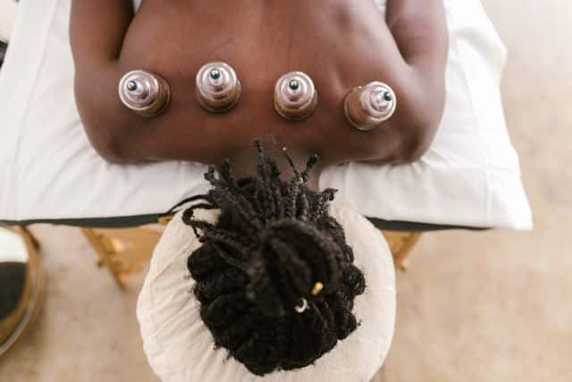Cupping therapy applied to upper back muscles for auto injury rehabilitation.